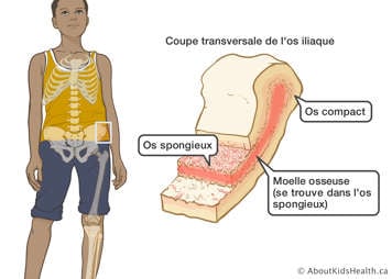 ”Illustration du skeleton montrant où se trouve l'os iliaque aussi qu'une coupe transversale de l'os iliaque