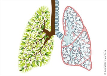 Lungs showing one side as a tree with branches and green leaves, the other side with bronchi, bronchioles and alveoli